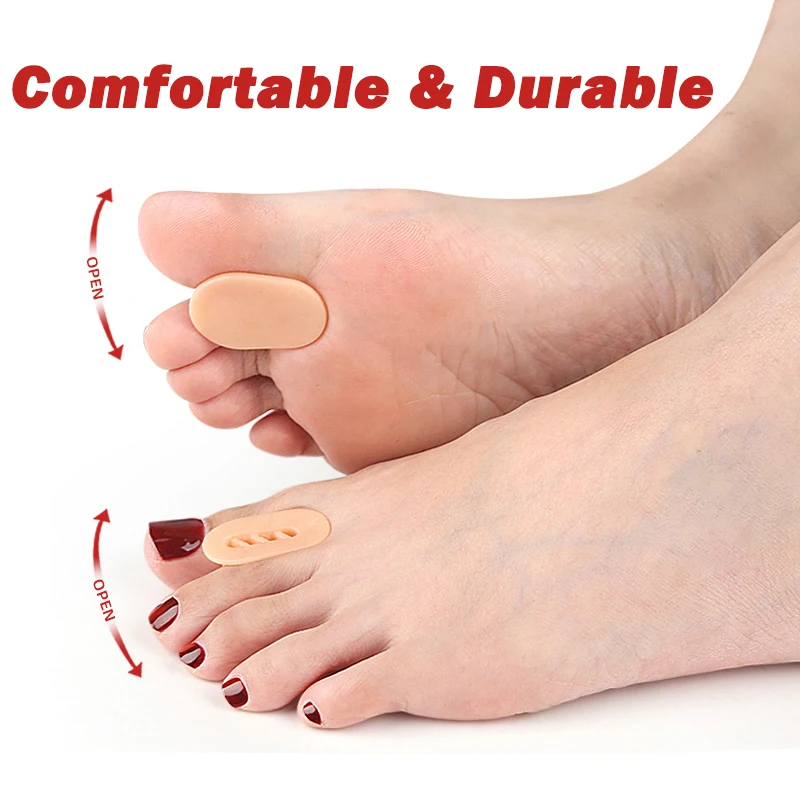 Pexmen 2/4 قطعة فواصل أصابع القدم من الجل مصحح الورم فواصل أصابع القدم لتقويم العظام إلى شكلهم الأصلي للرجال والنساء #2
