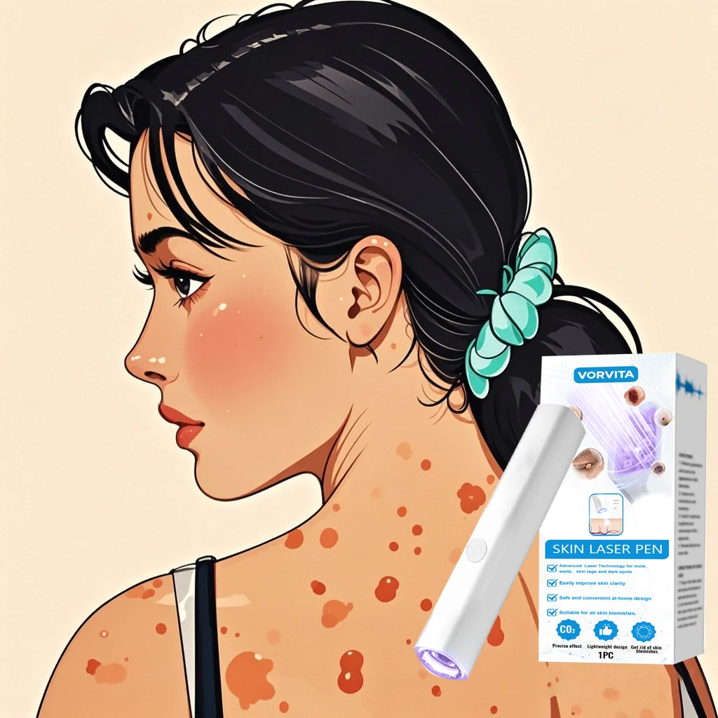 

1st ᵍᵉⁿᵉʳᵃᵗⁱᵒⁿ ᵘᵖᵍʳᵃᵈᵉᵈ wᵃʳᵗ ⸴ ʳᵉpᵃⁱʳ wᵃʳᵗˢ ʳᵒoᵗ ⸴ ᑫᵘⁱᶜᵏˡʸ New