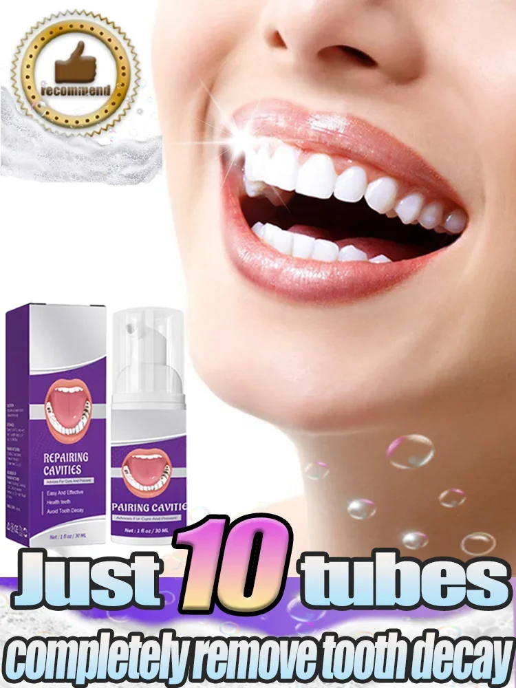 

Remove Cavities Effective Teeth Whitening Calculus Plaque Periodontitis Decay Whitening Yellowing Plaque Stains Decay