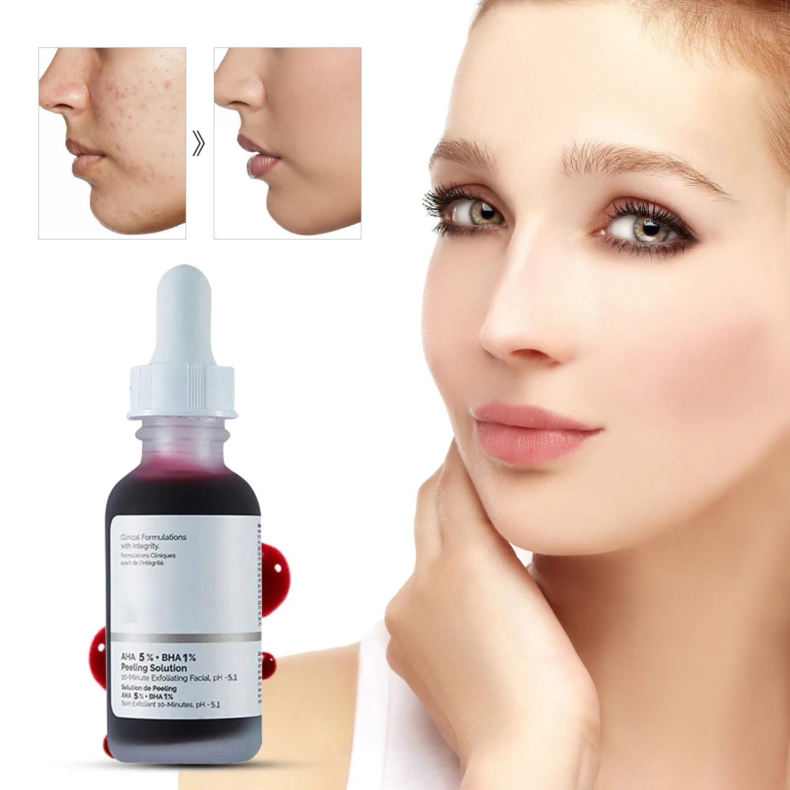 2024 New Fruit Concentration Liquid Fruit Primary Liquid Salicylic Skin Activating Serum Hydrating Facial Concentration 32ml