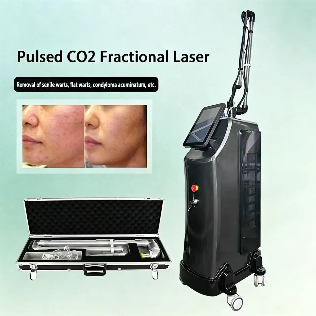 Co2 Laser Fractional Machine Co2 Laser Fractional Hair Removal 2027 New Popular Wart Removal