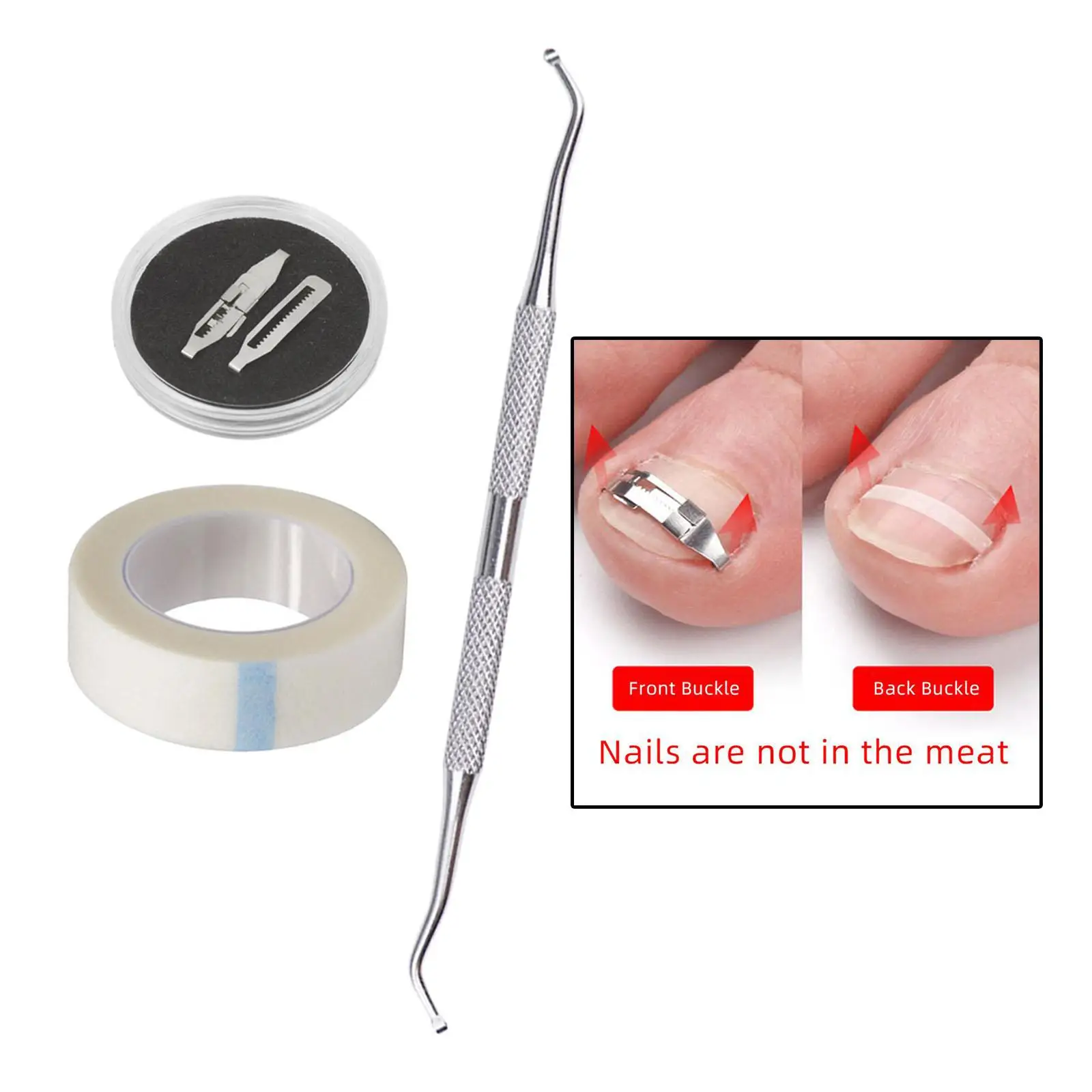 Professionele ingegroeide teennagelcorrectorhulpmiddelen Ingebouwde teennagelsbehandeling