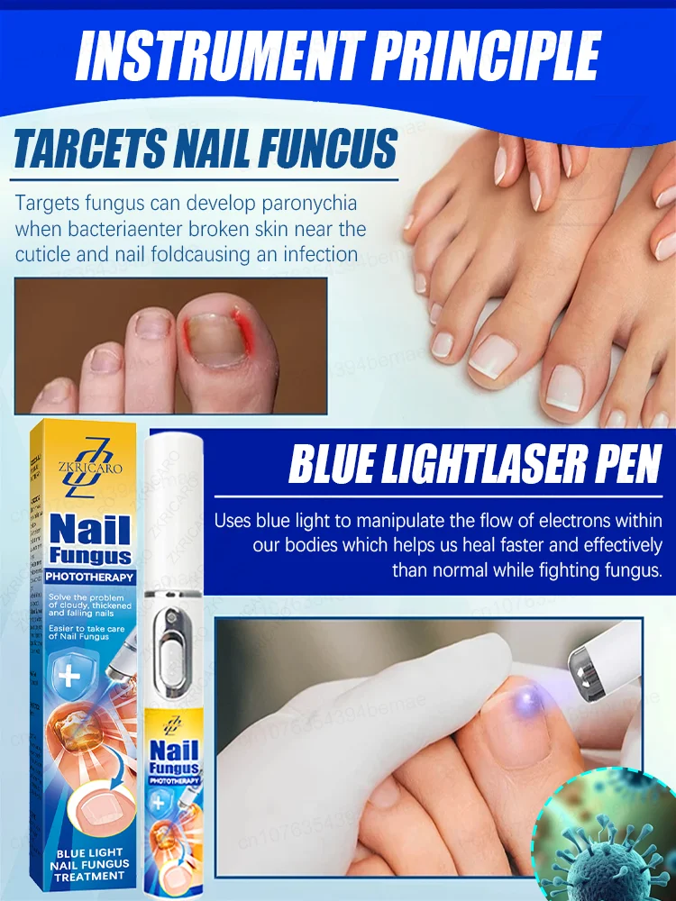 Les ongles deviennent sains et lisses sans avoir à se soucier des mycoses.