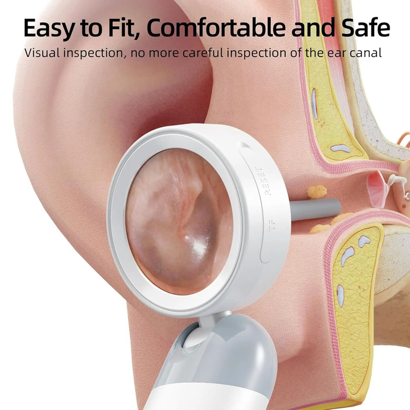 【Father’S Day】2X Wireless Ear Otoscope With 1080P HD Camera And 4 LED Lights 1.38Inch IPS Display Ear Camera With Inspection Hea