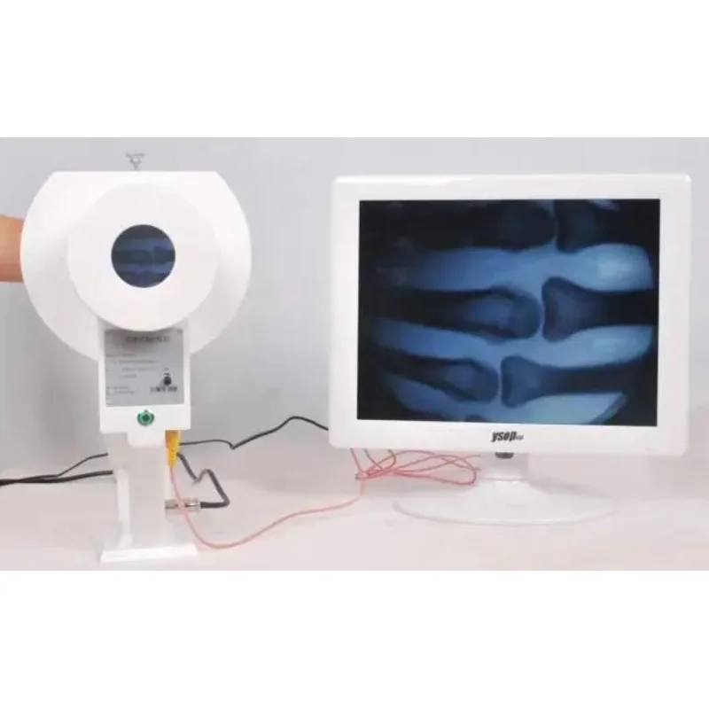 

Cheapest Low Dose Portable X-ray Machine Handheld Fluoroscopy Machine Price for Sale