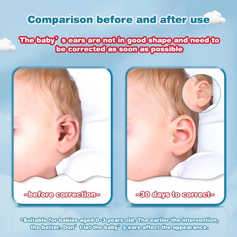 1 rotolo 4 cm × 0,5 m Correttore per orecchie per bambini Correzione per orecchie sporgenti per bambini Correttori estetici per orecchie in silicone Adesivo patch