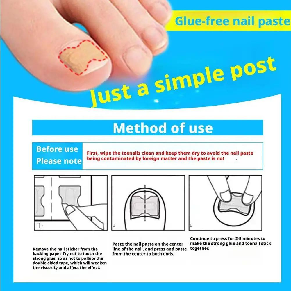 

Nail Fungus Patch Waterproof Nail Repair Patch Ingrown Correction Sticker Damaged Nail Gray Care Patch