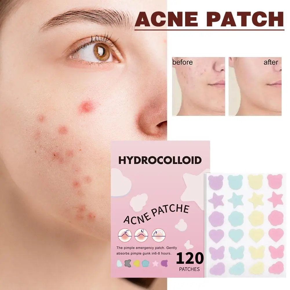 New Acne Pimple Patch Stickers Acne Treatment Pimple Spot Blemish Tool SHEETS Skin Mask Remover Facial Care 5 Waterproof U3G5