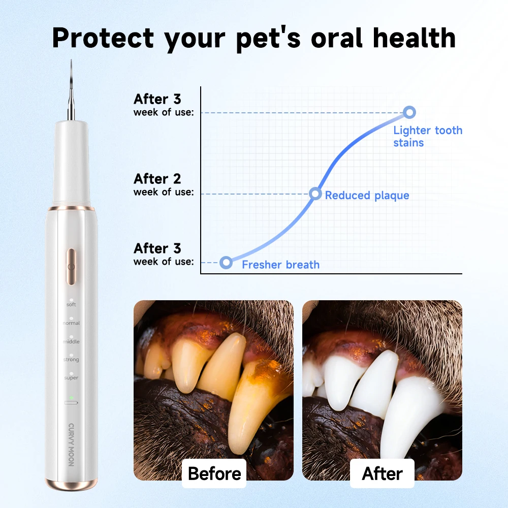 Thumbnail 2 - #7 Compare Ultrasonic Scalers Before You Buy