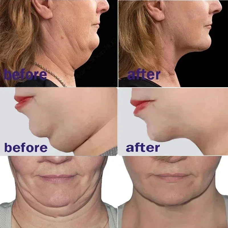 V-Shape Face Slimming Cream Remove Double Chins Firming Lifting Up V Cheek Fat Burning Anti-aging Shaping Massage Care Products