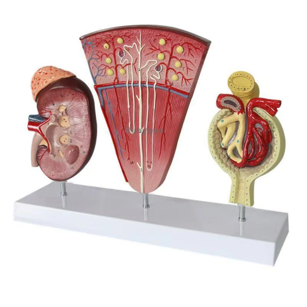 Educational Model Human Organ Anatomical Model Kidney Template with Urinary Glomerular Medical Model for Medical Education