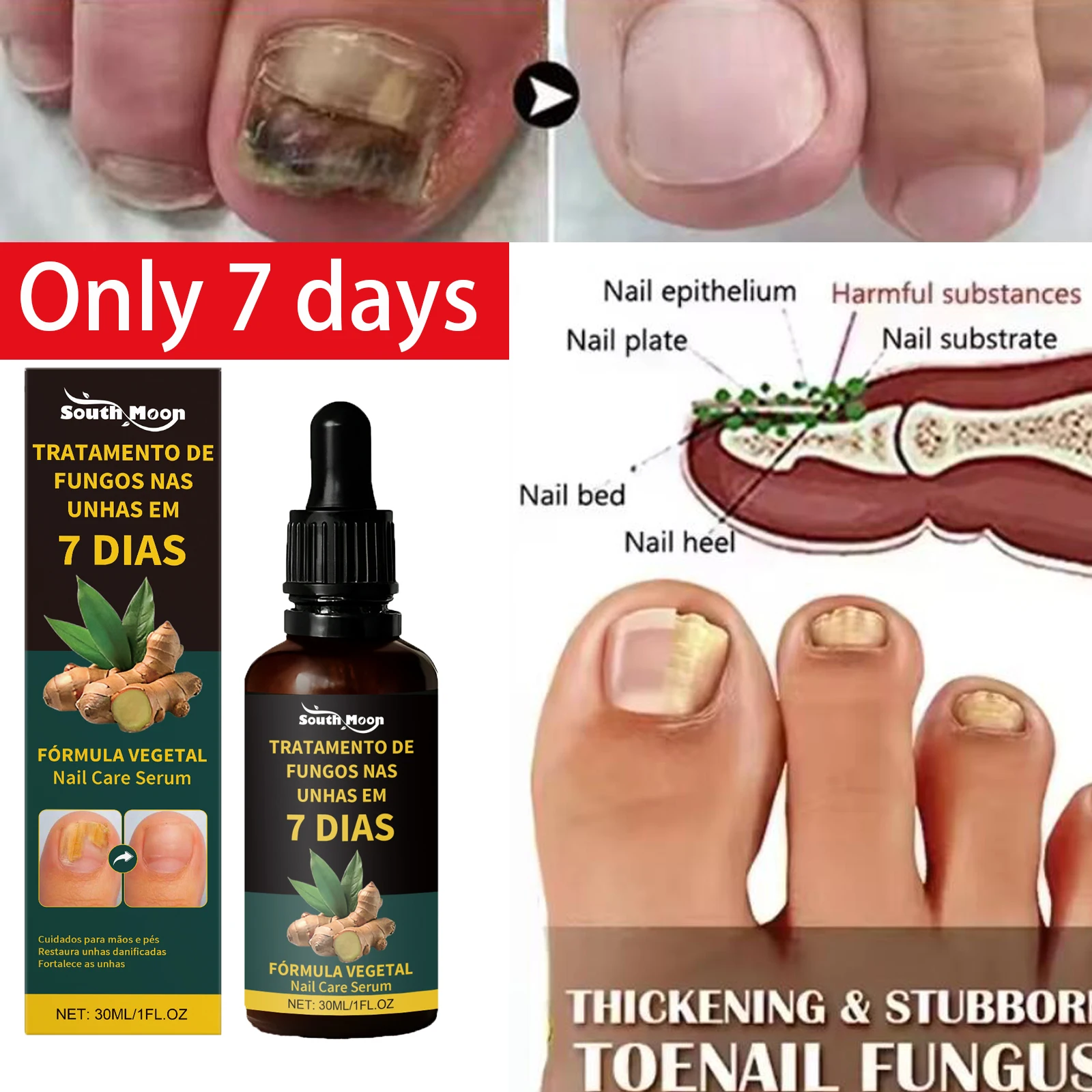 

Fungal Nail Renewal, Restores Appearance of Discolored or Damaged Nails