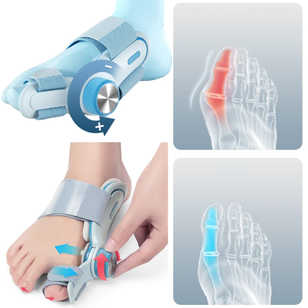 Bunion Corrector Adjustable Bunion Straightener with 3 Different Angle Fixing Plate Big Toe Straightener for Big Toe Correction