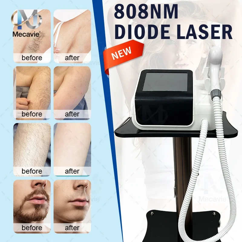 New 2026 4000W Mini Diode Hair Removal Device Adopts A Four-Waves System Precisely Match Different Skin Types 808 940 1064 755nm