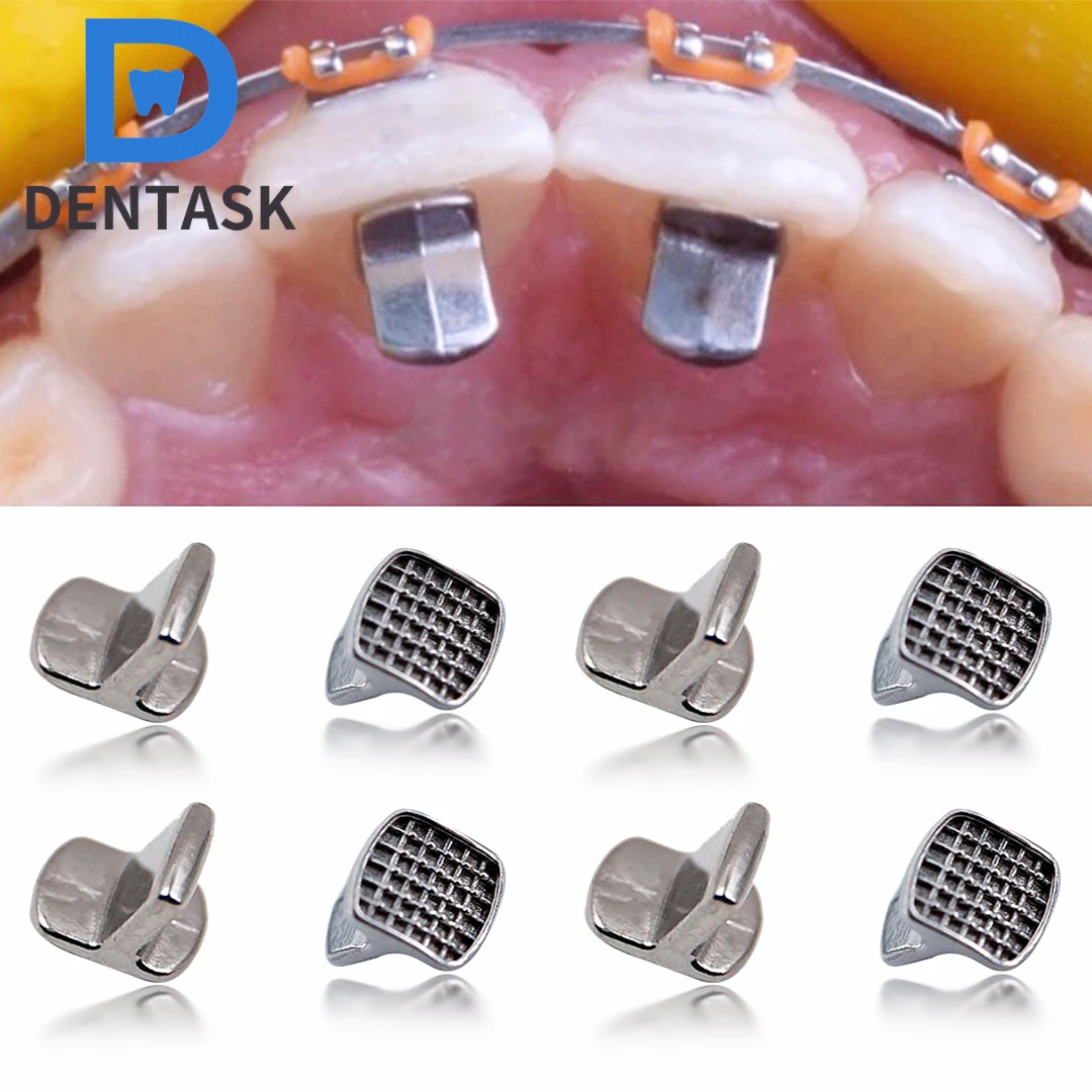 10pcs/bag DENTASK Fogászati orthodontic MIM monoblock falatot turbos Fém falatot Dugasz egységes Épületszárny Nyelv Szeliditő lingual spikes