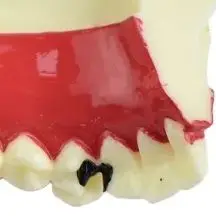 

Ортодонтические брекеты, демонстрационная ткань для нижней щелочки, зубы, анатомическая модель, исследование пациента, модель разложения