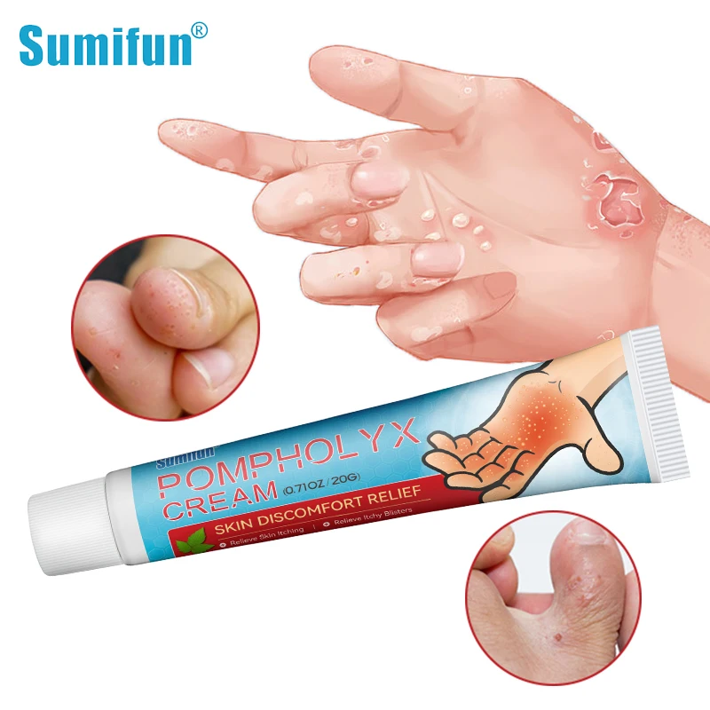 

Sumifun Pompholyx Cream Dyshidrosis Eczema Rapid Treatment Ointment Skin Fungus Killer Itchy Hand Foot Anti Infection Medication