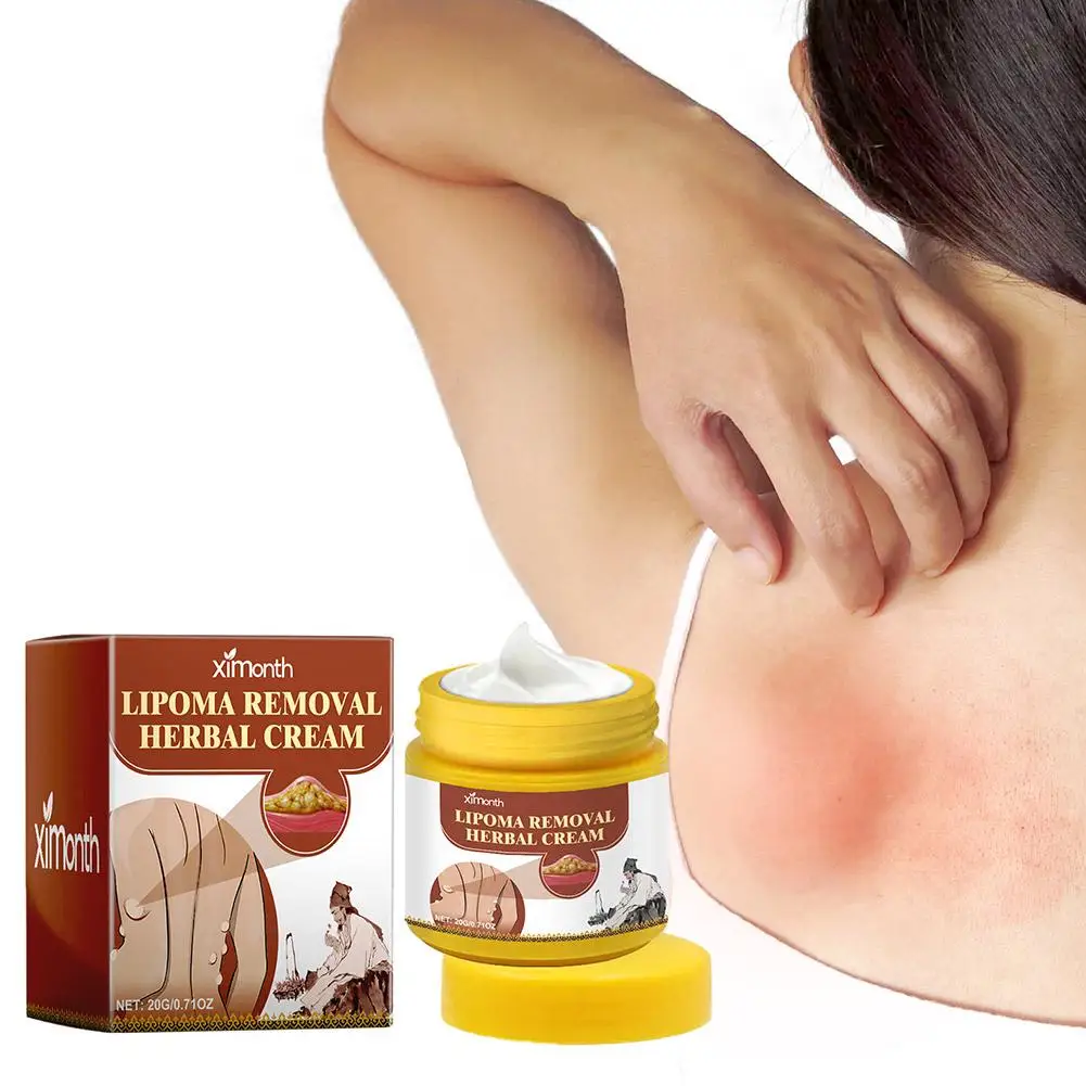 Creme Corporal Herbal Lipoma Removal, Dissolvendo Gordura, Fácil de Usar, 20g, 1Pc