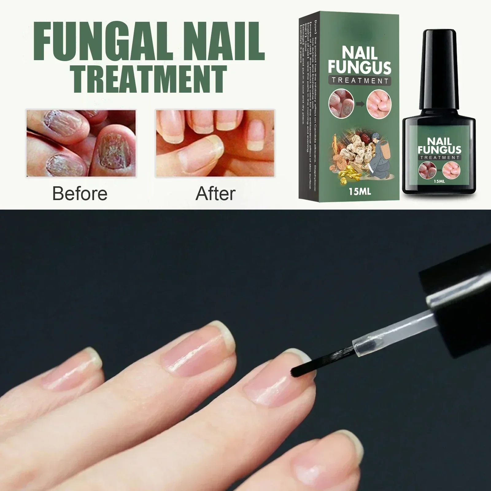 Nail Fungal Treatment Essence Oil Foot Toe Nail Fungus Removal Serum 7 Days Repair Onychomycosi Anti Infection Gel Care Products