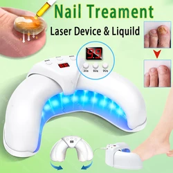 Nail Fungus Laser Treatment Device Fingernail Fungus Treat Onychomycosis Therapy Effectively Remove Onychomycosis Grow Toe Nail