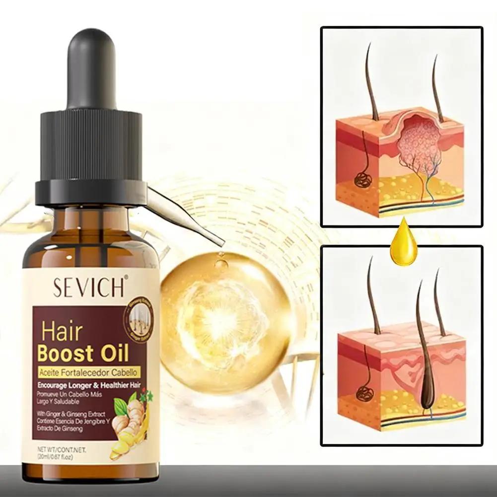 

30/20ML Hair Care Essence Oil Ginger Oil Anti Hair Loss Prevent Baldness Treatment Fast Nourish Scalp Hair Care