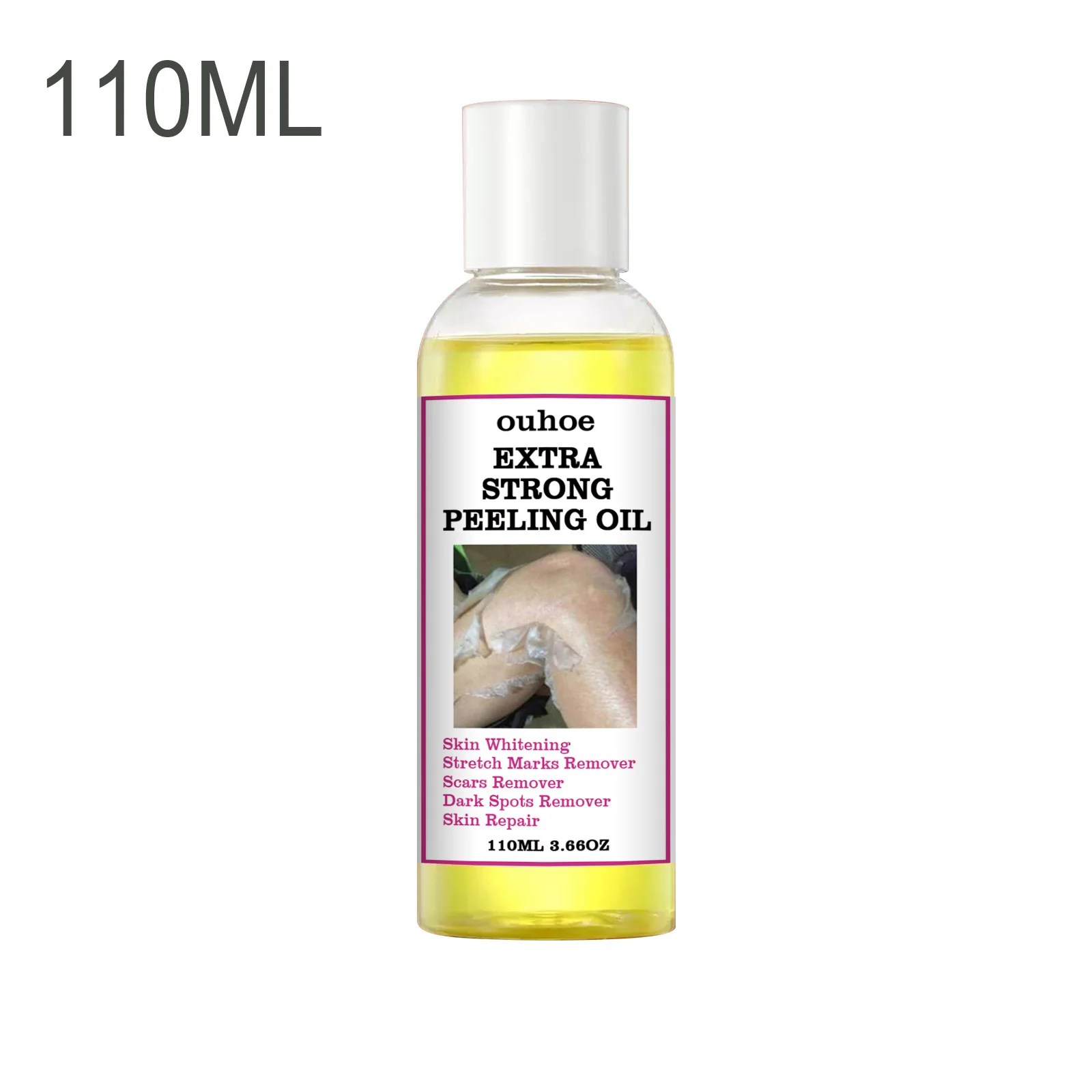 110ml Yellow Peeling Oil for Dark Skin Bleaching Lighten Elbows Knee Hands Brightening Skin Tone Facial Body Oil