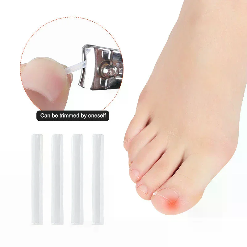 المهنية نام أظافر القدم مصحح ملصقات مجموعة تو العناية بالأظافر أدوات باديكير الرعاية الصحية يحمي علاج الداحس #4