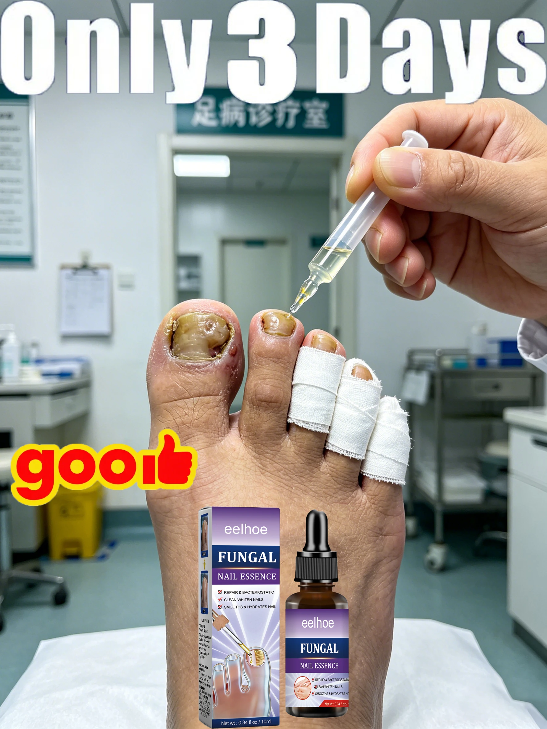 

2026 Toenail Fungus Patch Waterproof Nail Repair Patches Nail Ingrown Correction Sticker Discolored Damaged Nail Foot Care Tool