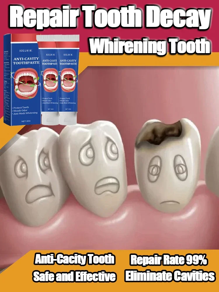 

02 Teeth Whitening Repair of Cavities Caries Removal of Plaque Stains Decay Repair Teeth Treating Dental Calculus