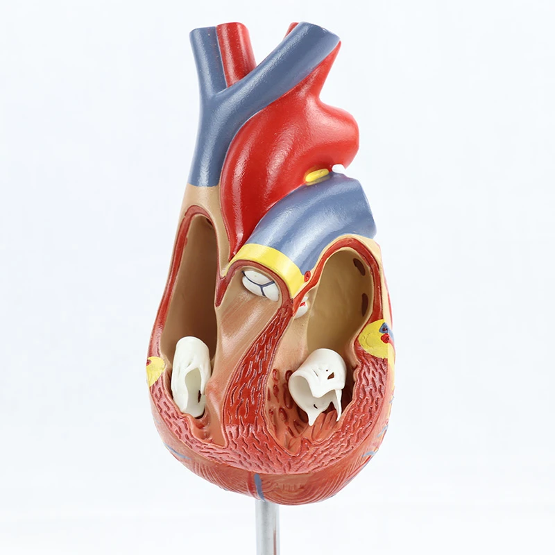 Medical Simulation Removable Anatomical Life Size Heart Cardiovascular Anatomy Thrombotic Vascular Model Teaching Supplies