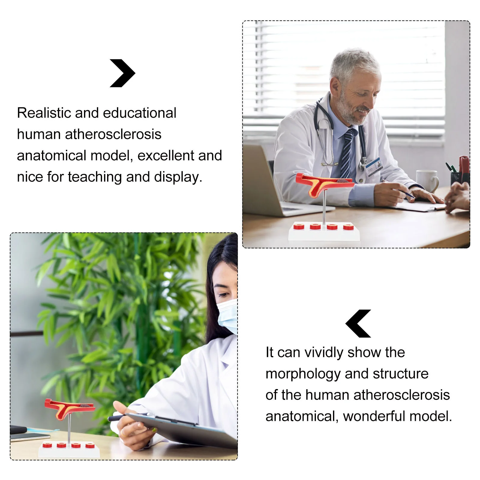 Ferramenta modelo vascular aterosclerose cardiovascular display em pvc vaso sanguíneo médico