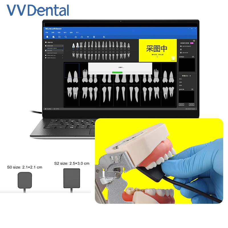 VVDental Dental Sensor X-Ray Digital Sensor Intraoral Digital System HD Image RVG Senor Dentistry Lab Tools