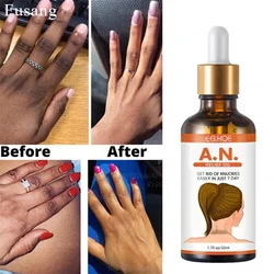 Elbow Knee Brighten Serum Hand Knuckle Powerful Brightening Essence Dark Knuckles Remove Stains Serum Black Skin Lightening Care