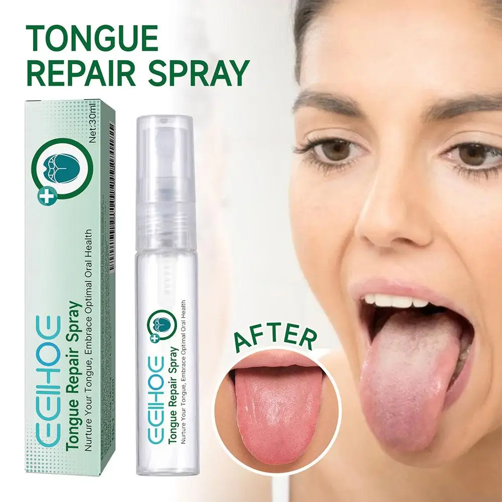 EELHOE Tongue Repair Spray Repair Tongue Whitening Dry, Oral Spray Cracked Care Swollen Relieve Tongue To And A0T7