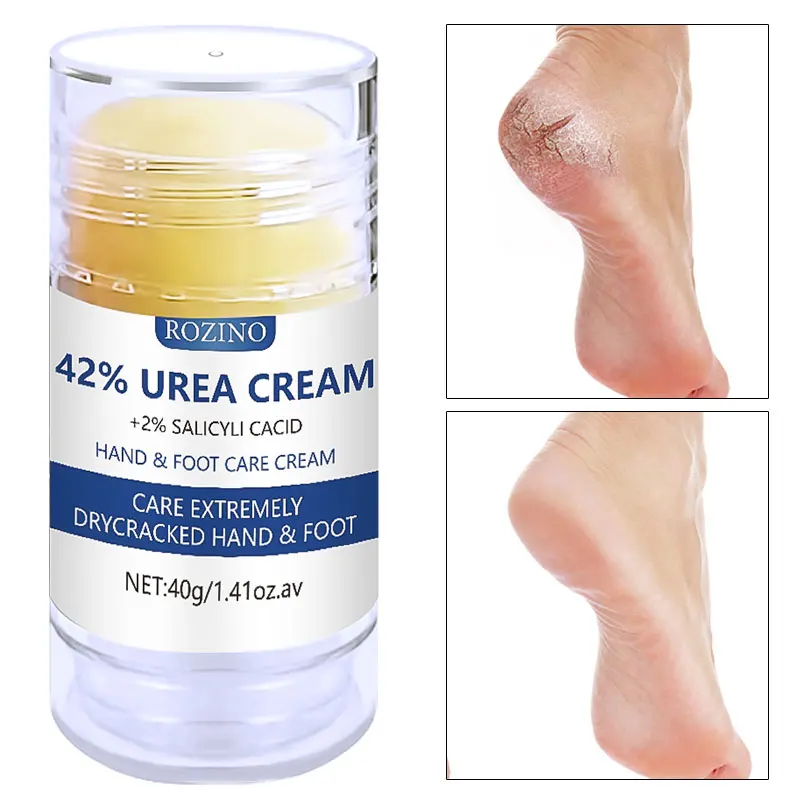 1.41oz 42% Urea Foot Hand Care Cream Stick, Used For Heel Care, Deeply Moisturizing And Nourishing Your Dry Rough Skin