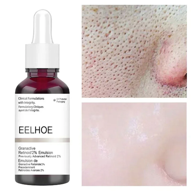 

Salicylic Acid Pore Shrink Face Serum Hyaluronic Acid Moisturizing Nourish Smooth Pores Repair Essence Firm Skin Korean Cosmetic