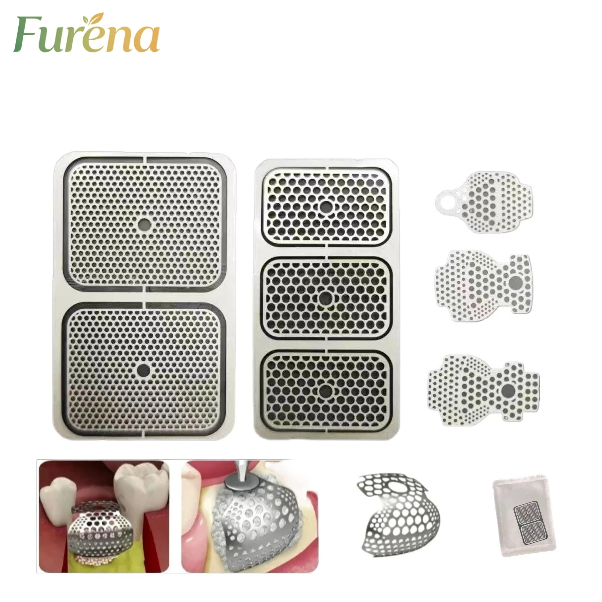 Dental OB2 3D Titanium Mesh for GBR Guided Bone Regeneration Membrane Plate Implant Formation Incremental SmartBuilder