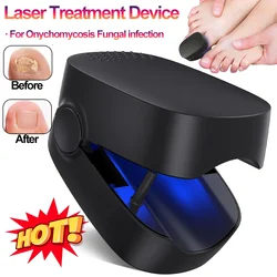 Nail Fungus Treatment LED Laser Device for Cleaning Onychomycosis USB Charge 905nm Infrared Light 470nm Blue Light Nail Salon