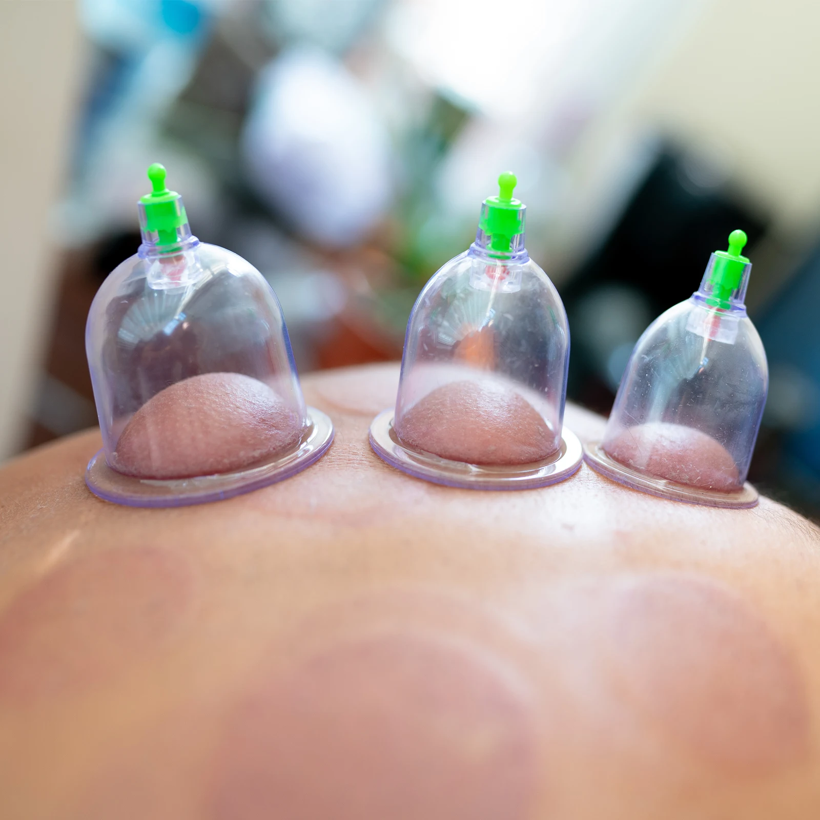 

1Set Professional Vacuum Suction Cupping Kit Transparent Durable Home Massage Tool Relax Muscle Improve Blood Flow Cupping