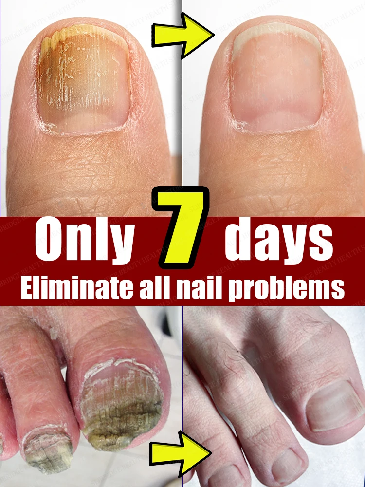 Get brand new nails instantly