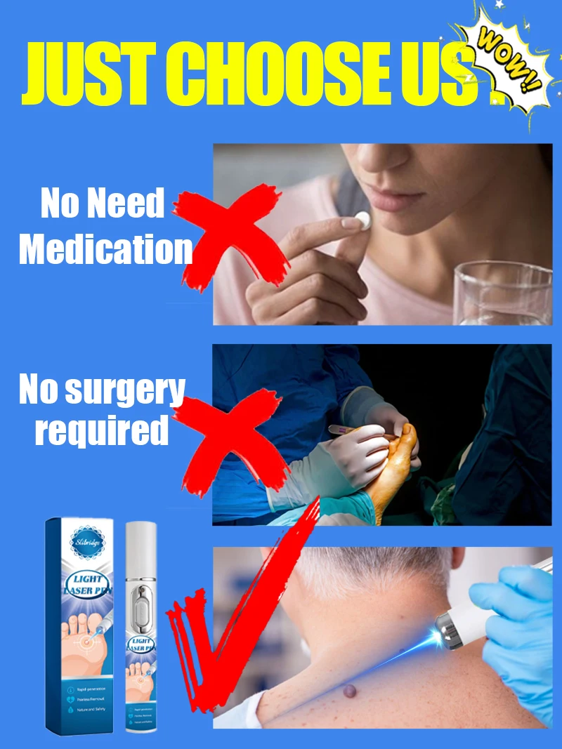 Stylo à lumière bleue pour résoudre les verrues corporelles, outils de soins des verrues