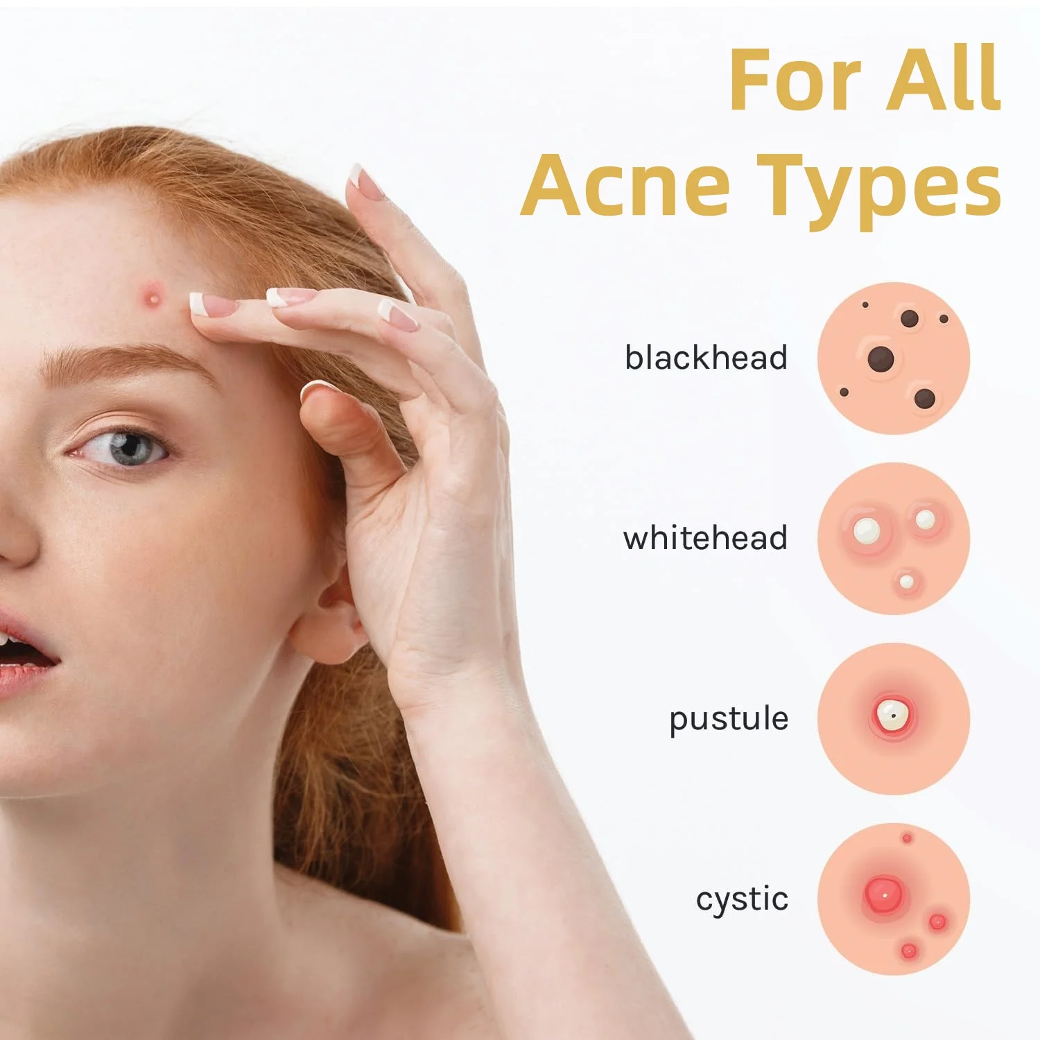 375pcs Hydrocolloid Acne Patches – Invisible Waterproof Spot Covers for All Skin Types, Day & Night Blemish Care
