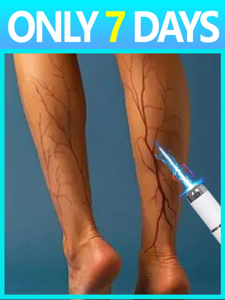 

Лазер третьего поколения: Прощай, проблемы с ногами, за 7 дней!