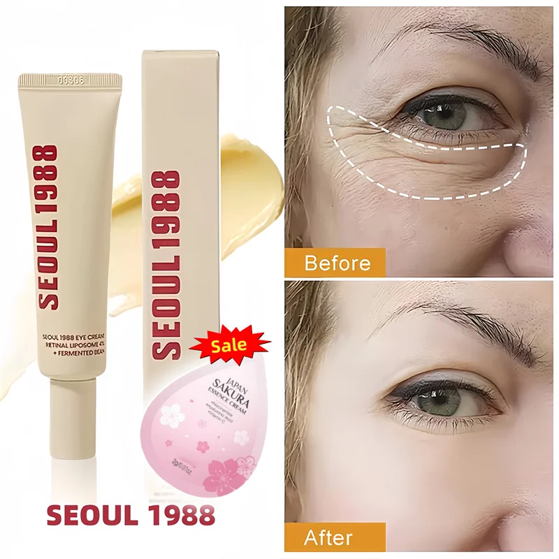 

SEOUL 1988 Retinol Eye Cream 4% Anti Aging Eye Treatment Dark Circles, Wrinkles, Puffiness Firming & Lifting Eye Cream For Women