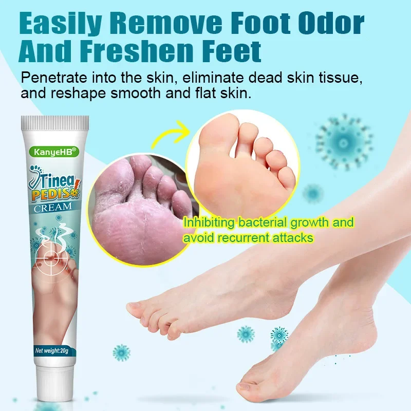 Foot Deodorant Cream Foot Odor Bacteriostasis Antipruritic Athlete\'s Foot Ointment Skin Topical Cream Personal Health Care