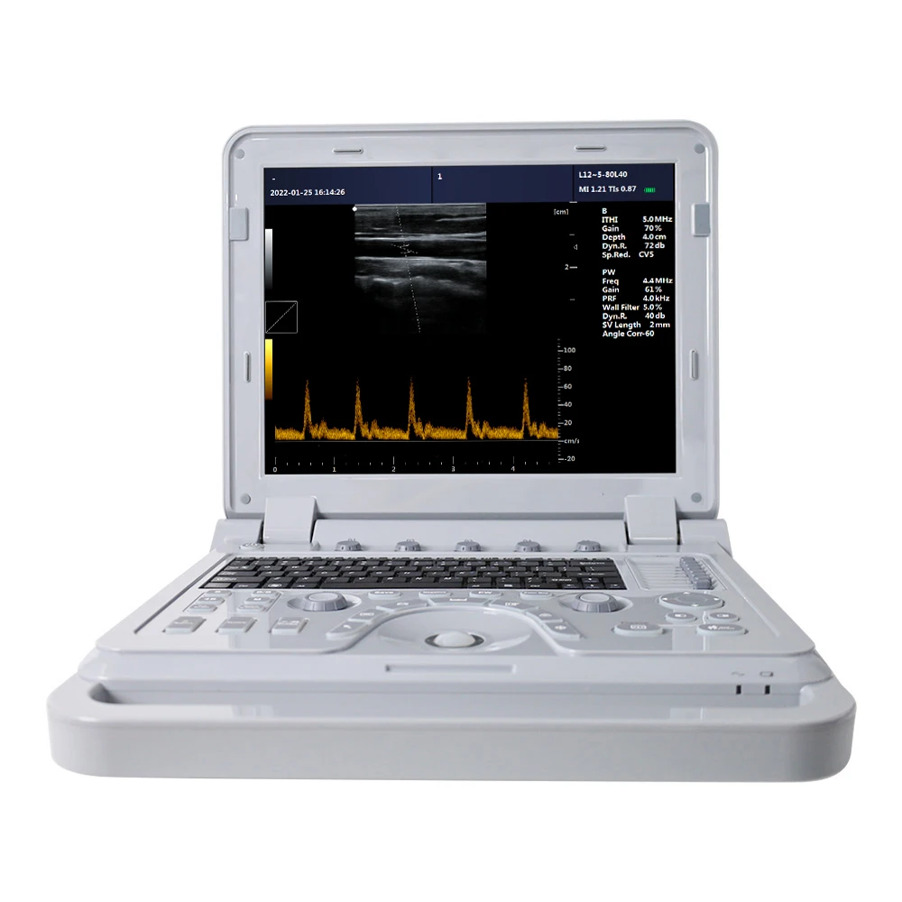 CONTEC CE CMS600P2PLUS Digital Notebook China ultrasound diagnostic system portable ultrasound scanner device