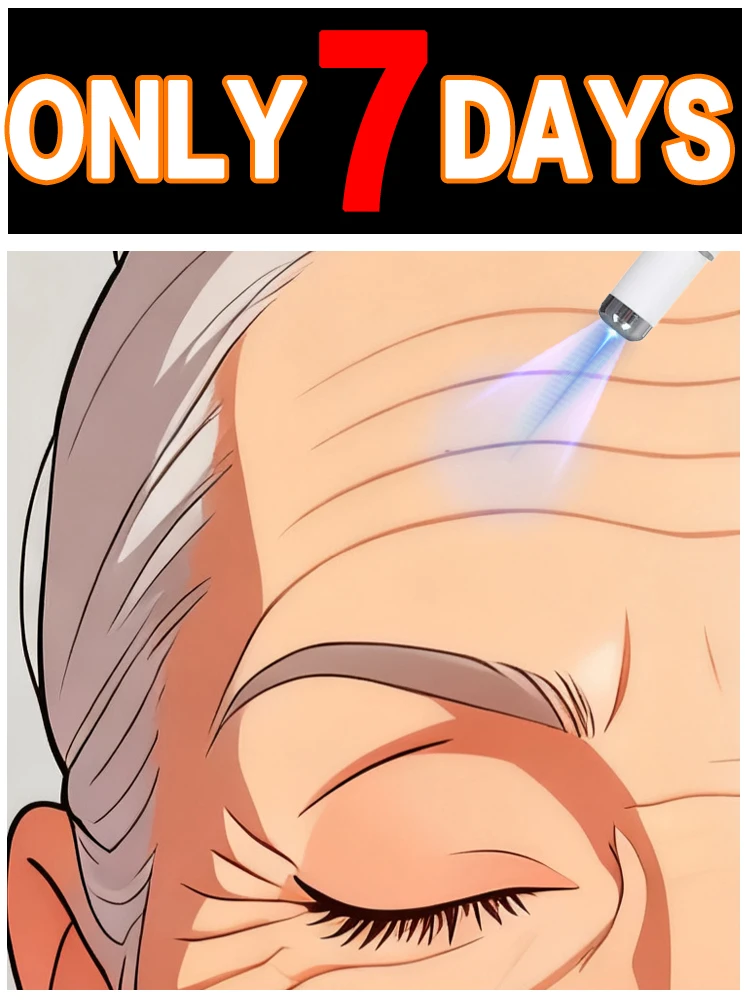 قلم الضوء الأزرق الأكثر مبيعًا لحل تجاعيد الوجه، أداة العناية بالتجاعيد