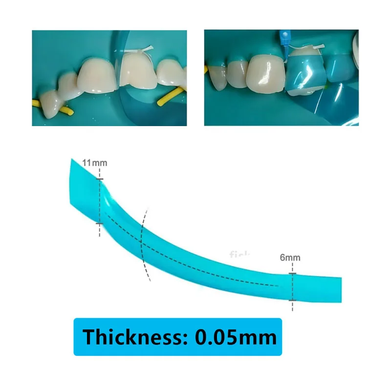 Dental konturierte vordere Matrize, Metallmatrize, blauer Streifen, Restaurationsmatrize, transparenter Bogen, vordere Matrizen, Zahnarztmaterialien – Detail 3