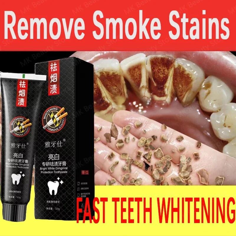 

Fast Remove Smoke Stains Toothpaste Teeth Whitening Strips Remove Plaque Stains Oral Hygiene Cleansing Fresh Breath Dental Tools