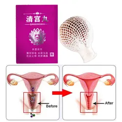 Pílula Vaginal da Medicina Herbal Chinesa, Pérola Anti-Inflamatória, Cuidados de Saúde Feminina, Desintoxicação, Qinggong, 1 Comprimido